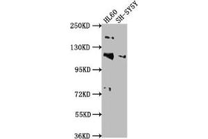 Western Blot Positive WB detected in: HL60 whole cell lysate, SH-SY5Y whole cell lysate All lanes: RAPGEF1 antibody at 1:2000 Secondary Goat polyclonal to rabbit IgG at 1/50000 dilution Predicted band size: 121, 117, 123 kDa Observed band size: 121 kDa (GRF2 抗体  (AA 22-40))