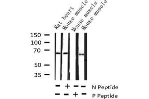 Western Blotting (WB) image for anti-Forkhead Box O4 (FOXO4) (pSer197) antibody (ABIN6255069)