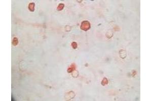 Immunohistochemistry (IHC) image for anti-KSHVK8a antibody (ABIN2464074) (KSHVK8a 抗体)