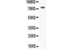 Anti- RIP antibody, Western blotting All lanes: Anti RIP  at 0. (RIPK1 抗体  (Middle Region))