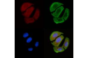 ABIN6258526 and ABIN6274768 staining Hela cells(30 min of UV treatment) by IF/ICC.