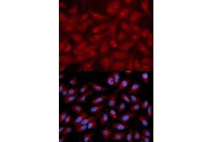 Immunofluorescence analysis of U2OS cells using RAPGEF3 antibody. (RAPGEF3 抗体  (AA 1-200))