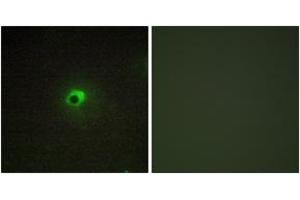 Immunofluorescence (IF) image for anti-Activin Receptor Type 1C (ACVR1C) (AA 201-250) antibody (ABIN1534006)