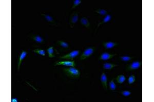 Immunofluorescence (IF) image for anti-EGF, Latrophilin and Seven Transmembrane Domain Containing 1 (ELTD1) (AA 85-299) antibody (ABIN7143395)