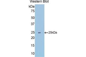 Western blot analysis of the recombinant protein. (SLIT1 抗体  (AA 3-211))
