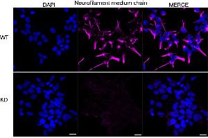anti-Neurofilament Triplet M Protein (NEFM) antibody