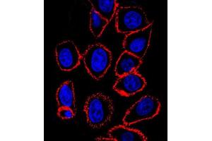 CD44 antibody (ABIN659120 and ABIN2843760) confocal immunofluorescent analysis with hela cell. (CD44 抗体)