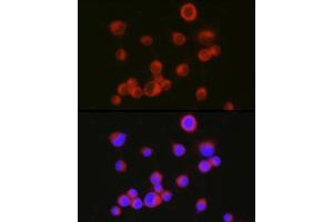 Immunofluorescence analysis of Neuro-2a cells using [KO Validated] CD171/L1CAM Rabbit pAb (ABIN6131538, ABIN6143053, ABIN6143054 and ABIN7101826) at dilution of 1:150 (40x lens). (L1CAM 抗体  (AA 1143-1257))
