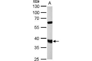 Western Blotting (WB) image for anti-Farnesyl Diphosphate Synthase (FDPS) antibody (ABIN2856081)