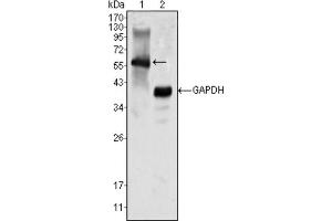 Western blot analysis using MATK antibody against K562 cell lysate (1). (MATK 抗体)