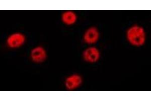 ABIN6275067 staining MCF7 by IF/ICC. (POLI 抗体  (N-Term))