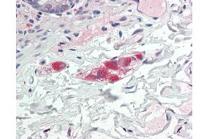 Immunohistochemistry (IHC) image for anti-Secretagogin, EF-Hand Calcium Binding Protein (SCGN) (C-Term) antibody (ABIN2627872)