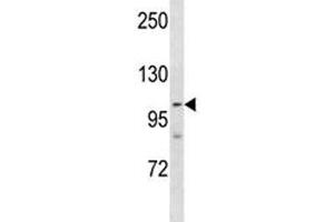 PARP 1 antibody western blot analysis in NCI-H460 lysate.