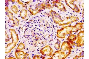 Immunohistochemistry (IHC) image for anti-V-Set Domain Containing T Cell Activation Inhibitor 1 (VTCN1) (AA 26-258) antibody (ABIN7175204)