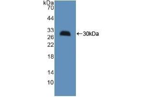 Detection of Recombinant HMGCS, Mouse using Polyclonal Antibody to Hydroxymethylglutaryl Coenzyme A Synthase (HMGCS) (HMGCS1 抗体  (AA 1-238))