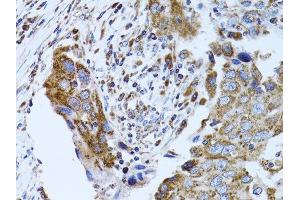 Immunohistochemistry (Paraffin-embedded Sections) (IHC (p)) image for anti-Fatty Acid Binding Protein 4, Adipocyte (FABP4) (AA 1-132) antibody (ABIN3020736)
