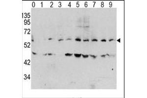 Western blot analysis of phospho c-Myc antibody and human TPA activated HeLa cells/lysate (0: without TPA (c-MYC 抗体  (pThr58))