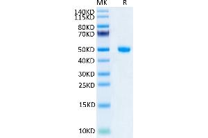 Human NGAL/Lipocalin-2 on Tris-Bis PAGE under reduced condition. (Lipocalin 2 Protein (LCN2) (AA 21-198) (Fc Tag))