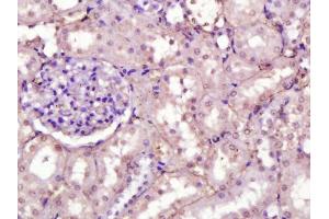 Paraformaldehyde-fixed, paraffin embedded rat kidney, Antigen retrieval by boiling in sodium citrate buffer (pH6) for 15min, Block endogenous peroxidase by 3% hydrogen peroxide for 30 minutes, Blocking buffer (normal serum) at 37°C for 20min, Antibody incubation with Fibronectin (1B9) Monoclonal Antibody  at 1:200 overnight at 4°C, followed by a conjugated secondary and DAB staining. (Fibronectin 抗体  (AA 2240-2280))