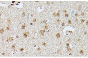 Immunohistochemistry of paraffin-embedded Rat brain using IGHMBP2 Polyclonal Antibody at dilution of 1:100 (40x lens). (IGHMBP2 抗体)