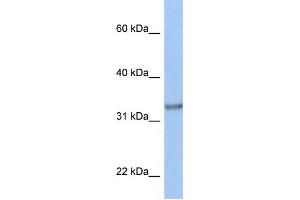 Western Blotting (WB) image for anti-Acyl-CoA Binding Domain Containing 4 (ACBD4) antibody (ABIN2459338) (ACBD4 抗体)