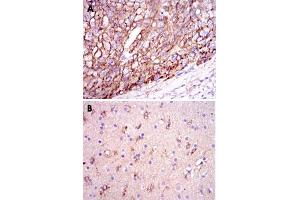 Immunohistochemical analysis of paraffin-embedded human liver cancer tissues (A) and brain tissues (B) using APOE monoclonal antibody, clone 1H4  with DAB staining. (APOE 抗体)