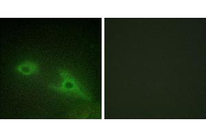 Peptide - +Western blot analysis of extracts from COLO205 cells, using EPHA1 antibody. (EPHA1 抗体  (Internal Region))