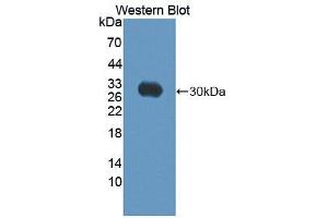 Western Blotting (WB) image for anti-ATP-Binding Cassette, Sub-Family C (CFTR/MRP), Member 10 (ABCC10) (AA 1246-1492) antibody (ABIN1866475)