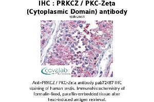 Image no. 2 for anti-Protein Kinase C, zeta (PRKCZ) (1st Cytoplasmic Domain) antibody (ABIN1738343) (PKC zeta 抗体  (1st Cytoplasmic Domain))