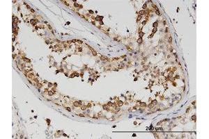 Image no. 2 for anti-Z-DNA Binding Protein 1 (ZBP1) (AA 2-101) antibody (ABIN599594) (ZBP1 抗体  (AA 2-101))