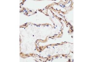 B staining TUBA4A in human lung tissue sections by Immunohistochemistry (IHC-P - paraformaldehyde-fixed, paraffin-embedded sections). (TUBA4A 抗体  (C-Term))