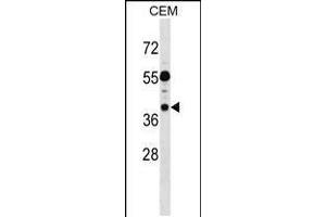 Western blot analysis in CEM cell line lysates (35ug/lane). (TSSC1 抗体  (C-Term))