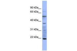 Image no. 1 for anti-Myosin, Light Chain 3 (MYL3) (AA 35-84) antibody (ABIN6741643) (MYL3/CMLC1 抗体  (AA 35-84))