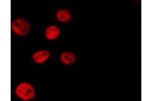 ABIN6267699 staining Hela by IF/ICC. (HDAC5 抗体  (pSer259))