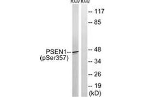Western blot analysis of extracts from RAW264. (Presenilin 1 抗体  (pSer357))