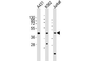 All lanes : Anti-RBMX Antibody (Center) at 1:2000 dilution Lane 1: A431 whole cell lysates Lane 2: K562 whole cell lysates Lane 3: Jurkat whole cell lysates Lysates/proteins at 20 μg per lane. (RBMX 抗体  (AA 222-252))