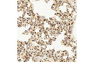 Immunohistochemistry (Paraffin-embedded Sections) (IHC (p)) image for anti-Telomeric Repeat Binding Factor 2, Interacting Protein (TERF2IP) antibody (ABIN7075857)