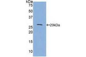 Western blot analysis of recombinant Mouse CD1d. (CD1d 抗体  (AA 56-271))