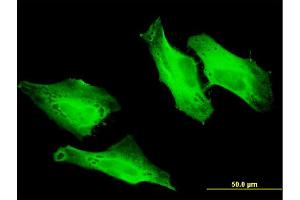 Immunofluorescence of monoclonal antibody to CEP57 on HeLa cell . (CEP57 抗体  (AA 19-128))