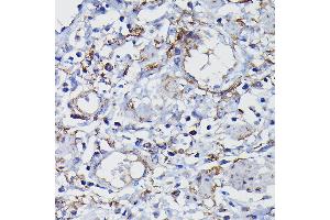 Immunohistochemistry (IHC) image for anti-Clusterin (CLU) (AA 23-120) antibody (ABIN6138756)