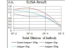 Black line: Control Antigen (100 ng), Purple line: Antigen(10 ng), Blue line: Antigen (50 ng), Red line: Antigen (100 ng), (SLC27A5 抗体  (AA 508-570))