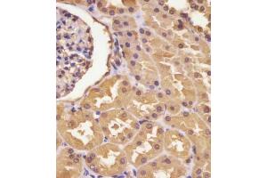 (ABIN390810 and ABIN2841047) staining ASS in human kidney tissue sections by Immunohistochemistry (IHC-P - paraformaldehyde-fixed, paraffin-embedded sections). (ASS1 抗体  (AA 192-221))