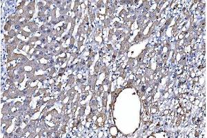 IHC analysis of GFPT1 using anti-GFPT1 antibody (ABIN7602887). (GFPT1 抗体  (C-Term))