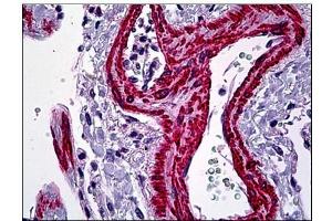 Immunohistochemistry (Paraffin-embedded Sections) (IHC (p)) image for anti-Actin, alpha 2, Smooth Muscle, Aorta (ACTA2) (N-Term) antibody (ABIN783900)
