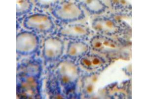 Used in DAB staining on fromalin fixed paraffin-embedded bowels tissue (KRT20 抗体  (AA 2-431))