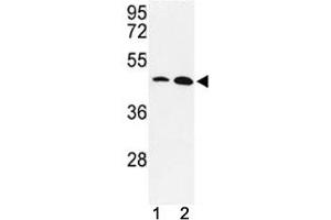 Western blot analysis of KLF4 antibody and MDA-MB231, NCI-H460 lysate. (KLF4 抗体  (AA 481-504))