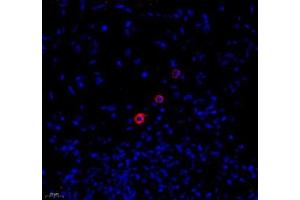 Immunofluorescence of paraffin embedded human colon using MADCAM1 (ABIN7074695) at dilution of 1:1800 (400x lens) (MADCAM1 抗体)