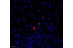 Immunofluorescence of paraffin embedded human colon using MADCAM1 (ABIN7074695) at dilution of 1:1800 (400x lens) (MADCAM1 抗体)
