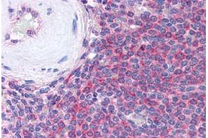 Human Spleen (formalin-fixed, paraffin-embedded) stained with THBS1 antibody ABIN305761 at 5 ug/ml followed by biotinylated anti-mouse IgG secondary antibody ABIN481714, alkaline phosphatase-streptavidin and chromogen. (Thrombospondin 1 抗体)