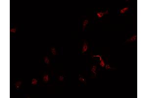 ABIN6269259 staining Hep G2 cells by IF/ICC. (GATA4 抗体  (Internal Region))